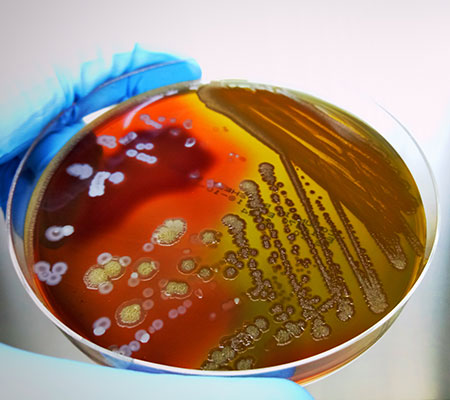 Sepsis, a medical emergency